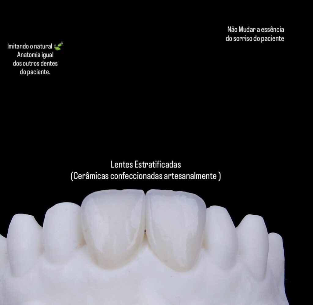 dente3
