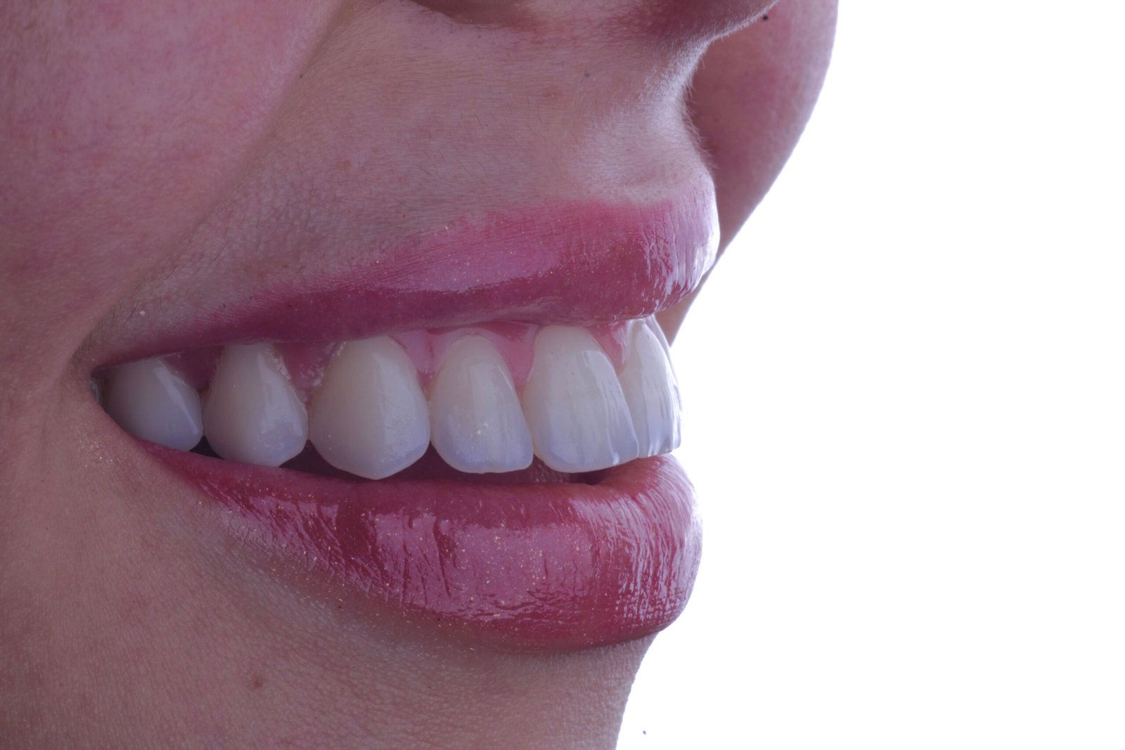 Vista lateral de um sorriso, com detalhes dos dentes anteriores