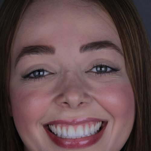 684165030_18054158357711649_8351538718983901844_n (1)