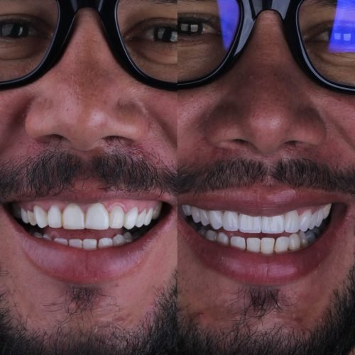 694205715_18055449101711649_6371211080178276755_n