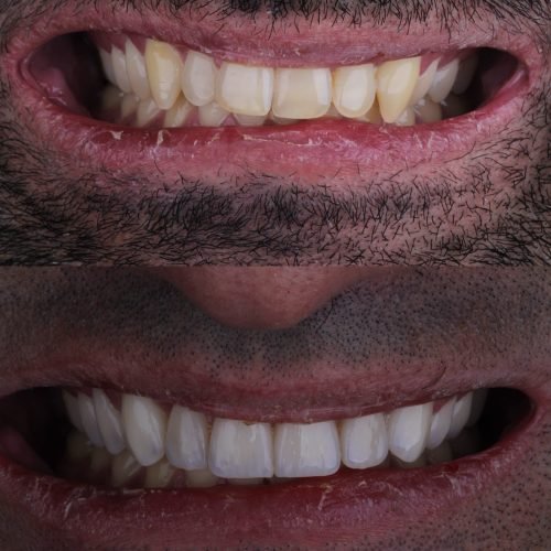 773028719_18069244253711649_9160571815454364180_n